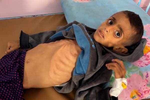 لماذا تغيب معاناة أطفال غزة عن الإعلام الأميركي؟